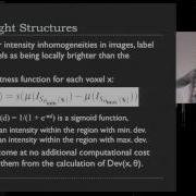 Effective Visualization Of Complex Vascular Structures
