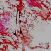 Lily ERROR オリジナル曲 English Subs Romaji