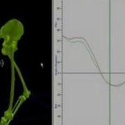 3D Running Analysis With Explanations
