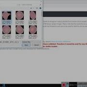 Malaria Detection Using Deeplearning CNN