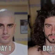 Two Years Time Lapse Of Hair Growth