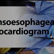Transoesophageal Echocardiogram