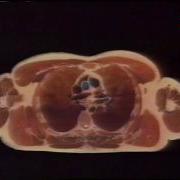 USA COMPUTERISED CADAVER AVAILABLE ON INTERNET