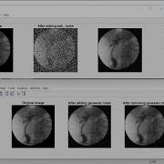 Basic Of Image Processing Using MATLAB 5 Remove Salt Pepper And Gaussian Noise By Filters