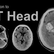 Introduction To CT Head Approach And Principles