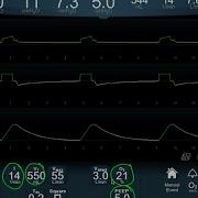 Vent Modes 101 Focus On The Waveform BAVLS
