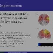 28 Inverse Problem EEG Source Localization 2