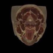 Visible Human Project Cross Section Of A Male Head
