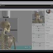 Meducoach X Ray Simulator Web