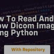 How To Read And Show Dicom Images Using Python