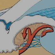 Description Of Angle Closure Glaucoma