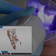 Digital Study Models