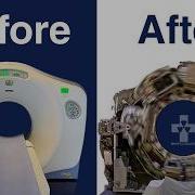 This Is The Fastest CT Scan Machine In The World CT Scanner Spinning With No Covers