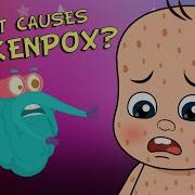 What Causes Chickenpox The Dr Binocs Show Best Learning Videos For Kids Peekaboo Kidz