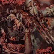 Aborted Coronary Reconstruction EP