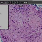 How To Use CaseCenter In BROWSER Mode