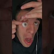 MY EYEBALL POPPED OUT