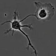 A Normal Neuron And A Mutated Neuron Develop Side By Side