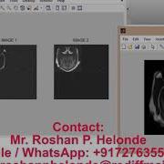 Matlab Code For Image Fusion Using Wavelet Transform