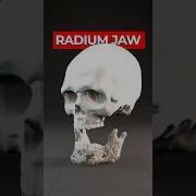 The True Story Of The Radium Girls