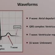 Intro To EKG Interpretation Waveforms Segments And Intervals