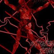 Lobotomy Incision Baby Killer Devourment Cover