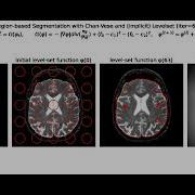 Region Based Segmentation Chan Vese Snakes Level Sets Gradient Descent Python