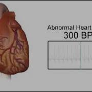Heart Beatin At 300 BPM
