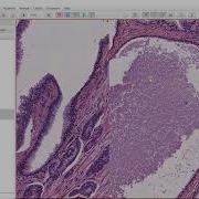 Pixel Classification With QuPath Epithelium And Stroma Segmentation With H E Images