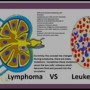 Non Hodgkin Lymphoma Medicine Minutes