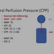 Introduction To Intracranial Pressure