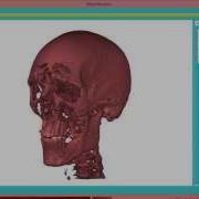 Volume Rendering With Qt Vol 8