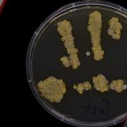 The Bacteria Living On Your Hands Right Now