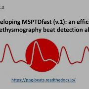 Developing MSPTDfast V 1 An Efficient Photoplethysmography Beat Detection Algorithm