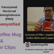 PNH Demystified With A Red Coffee Mug 2 Pink Paper Clips Pnh HemolyticAnemia