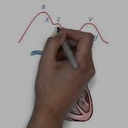 JVP Waveform Explained