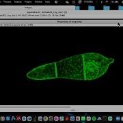 How To Process A Z Stack Image Into A 2D Image In ImageJ How To Process Confocal Microscope Images