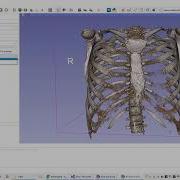 How To Enable GPU Volume Rendering In 3D Slicer