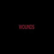 WOUNDS B Day Animation