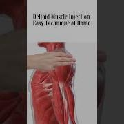 How To Give An Intramuscular IM Injection In Deltoid Muscle In Shoulder Easily At Home