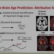 Oral 3 Matthias Wilms Towards Self Explainable Classifiers In Neuroimaging With Normalizing Flows