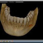 CS 3D Imaging Software Training CBCT Anatomical Review Of The Mandible