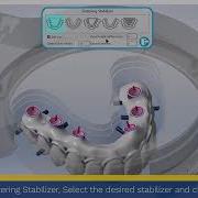 MillBox How To Adjust Sintering Stabilizer