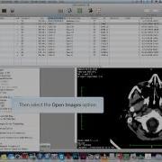 How To Use OsiriX