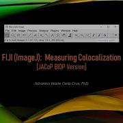 FIJI ImageJ Measuring Colocalization JACoP BIOP Version