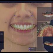3 RAYFace SW Ray Digital Smile Design