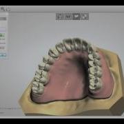3Shape Denture Designs Upper Lower Dentures