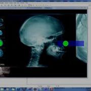 Kinect Effect Demo