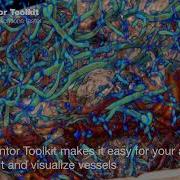 Vessels Segmentation And Visualization