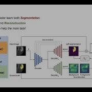 Multi Task Attention Based Semi Supervised Learning For Medical Image Segmentation